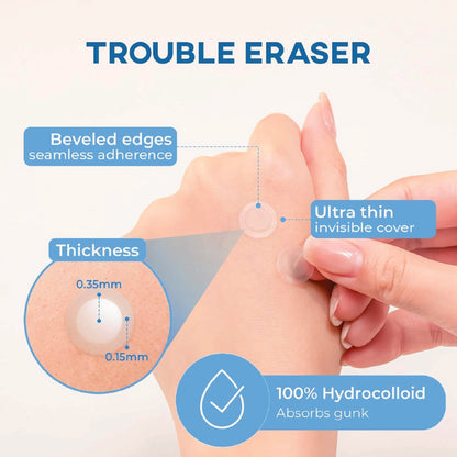 NOLAHOUR Spot Eraser Step 2 (Blue - Invisible + Spot Recovery Stage) 63 Patches