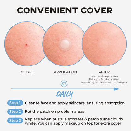 NOLAHOUR Spot Eraser Step 2 (Blue - Invisible + Spot Recovery Stage) 63 Patches