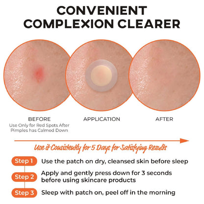 NOLAHOUR Spot Eraser Step 3 (Orange - Micropoint for Red Spot Stage) 12 Patches